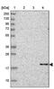 Cerebellin 3 Precursor antibody, PA5-59498, Invitrogen Antibodies, Western Blot image 