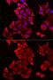 Mitochondrial import inner membrane translocase subunit Tim17-A antibody, GTX16468, GeneTex, Immunofluorescence image 