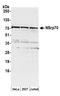 Nuclear Speckle Splicing Regulatory Protein 1 antibody, A304-658A, Bethyl Labs, Western Blot image 