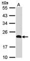 CKLF Like MARVEL Transmembrane Domain Containing 5 antibody, orb69796, Biorbyt, Western Blot image 