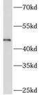 ADP-Ribosyltransferase 3 antibody, FNab00614, FineTest, Western Blot image 
