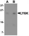 Lymphocyte Antigen 6 Family Member K antibody, TA319943, Origene, Western Blot image 