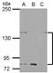 Potassium Voltage-Gated Channel Subfamily H Member 7 antibody, LS-C155746, Lifespan Biosciences, Western Blot image 
