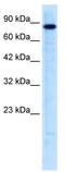 Ubiquitin Like With PHD And Ring Finger Domains 2 antibody, TA337863, Origene, Western Blot image 