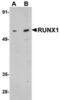 RUNX Family Transcription Factor 1 antibody, TA306772, Origene, Western Blot image 