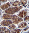 Connective tissue growth factor antibody, 63-198, ProSci, Immunohistochemistry paraffin image 