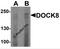 Dedicator Of Cytokinesis 8 antibody, 7847, ProSci, Western Blot image 