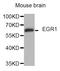 Early Growth Response 1 antibody, STJ29407, St John