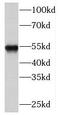 Asparaginyl-TRNA Synthetase 2, Mitochondrial antibody, FNab05557, FineTest, Western Blot image 