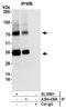 Monocarboxylate transporter 4 antibody, A304-439A, Bethyl Labs, Immunoprecipitation image 