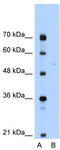 LP antibody, TA344015, Origene, Western Blot image 