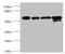 Chaperonin Containing TCP1 Subunit 2 antibody, LS-C675476, Lifespan Biosciences, Western Blot image 