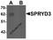 SPRY Domain Containing 3 antibody, 6405, ProSci, Western Blot image 