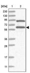 Ring Finger Protein 25 antibody, PA5-57650, Invitrogen Antibodies, Western Blot image 
