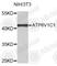 ATPase H+ Transporting V1 Subunit C1 antibody, A3755, ABclonal Technology, Western Blot image 