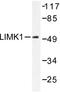 LIM domain kinase 1 antibody, LS-C176105, Lifespan Biosciences, Western Blot image 
