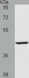 Acyl-CoA Dehydrogenase Short Chain antibody, TA321035, Origene, Western Blot image 