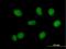 RecQ Mediated Genome Instability 1 antibody, H00080010-B02P, Novus Biologicals, Immunocytochemistry image 