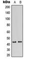 EGFR antibody, orb256508, Biorbyt, Western Blot image 