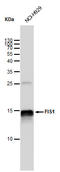 Mitochondrial fission 1 protein antibody, GTX630992, GeneTex, Western Blot image 