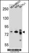 Rho GTPase Activating Protein 22 antibody, 56-795, ProSci, Western Blot image 