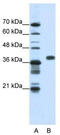 Poly(RC) Binding Protein 1 antibody, TA345948, Origene, Western Blot image 