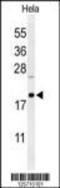 C-Type Lectin Domain Family 2 Member B antibody, 61-654, ProSci, Western Blot image 