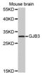 Gap Junction Protein Beta 3 antibody, A03199, Boster Biological Technology, Western Blot image 