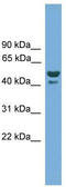 Anomalous Homeobox antibody, TA339858, Origene, Western Blot image 