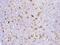 Matrix metalloproteinase-9 antibody, 10327-T24, Sino Biological, Immunohistochemistry frozen image 