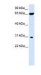 3-Hydroxyacyl-CoA Dehydratase 4 antibody, NBP1-59414, Novus Biologicals, Western Blot image 