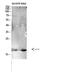 Leukocyte Associated Immunoglobulin Like Receptor 2 antibody, STJ97671, St John