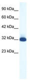 5-hydroxytryptamine receptor 1B antibody, TA330445, Origene, Western Blot image 