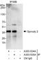 Sprouty RTK Signaling Antagonist 2 antibody, A303-534A, Bethyl Labs, Immunoprecipitation image 