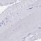 ALMS1 Centrosome And Basal Body Associated Protein antibody, PA5-60275, Invitrogen Antibodies, Immunohistochemistry frozen image 