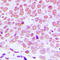 Jun Proto-Oncogene, AP-1 Transcription Factor Subunit antibody, LS-C352425, Lifespan Biosciences, Immunohistochemistry paraffin image 