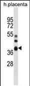 5'-Nucleotidase, Cytosolic IIIB antibody, PA5-71801, Invitrogen Antibodies, Western Blot image 