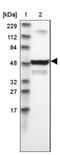 Uridine-Cytidine Kinase 1 Like 1 antibody, NBP1-83649, Novus Biologicals, Western Blot image 