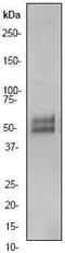 CD32 antibody, ab45143, Abcam, Western Blot image 