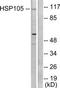 HSPH1 antibody, TA312324, Origene, Western Blot image 