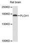 Phospholipase C Eta 1 antibody, A12903, ABclonal Technology, Western Blot image 