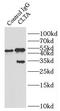 Clathrin Light Chain A antibody, FNab01777, FineTest, Immunoprecipitation image 