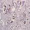 LYN Proto-Oncogene, Src Family Tyrosine Kinase antibody, orb106011, Biorbyt, Immunohistochemistry paraffin image 