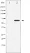 Serine/threonine-protein kinase 11 antibody, abx012325, Abbexa, Western Blot image 