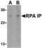 RPA Interacting Protein antibody, A11439, Boster Biological Technology, Western Blot image 