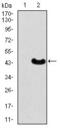Myocyte Enhancer Factor 2C antibody, GTX60668, GeneTex, Western Blot image 