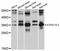 ATPase H+ Transporting V1 Subunit E2 antibody, LS-C747366, Lifespan Biosciences, Western Blot image 
