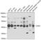 Deoxyhypusine synthase antibody, 22-163, ProSci, Western Blot image 
