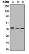 Radial Spoke Head 14 Homolog antibody, GTX56072, GeneTex, Western Blot image 
