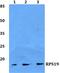 Ribosomal Protein S19 antibody, PA5-75564, Invitrogen Antibodies, Western Blot image 